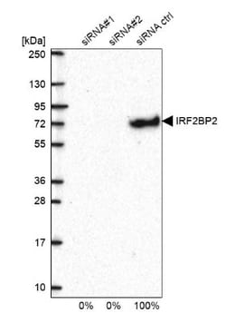 IRF2BP2 Antibody, Novus Biologicals:Antibodies:Primary Antibodies
